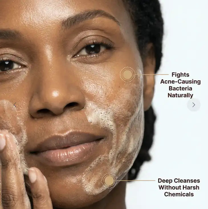 Anti-Dark Spots & Acne African Black Soap