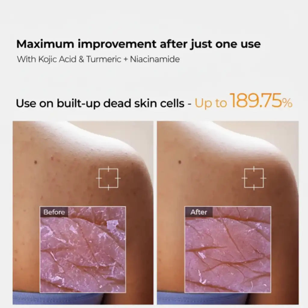 Coco beauty Peel Shot Exfoliating Spray by Dr. Melaxin | Smooth Brighter Skin