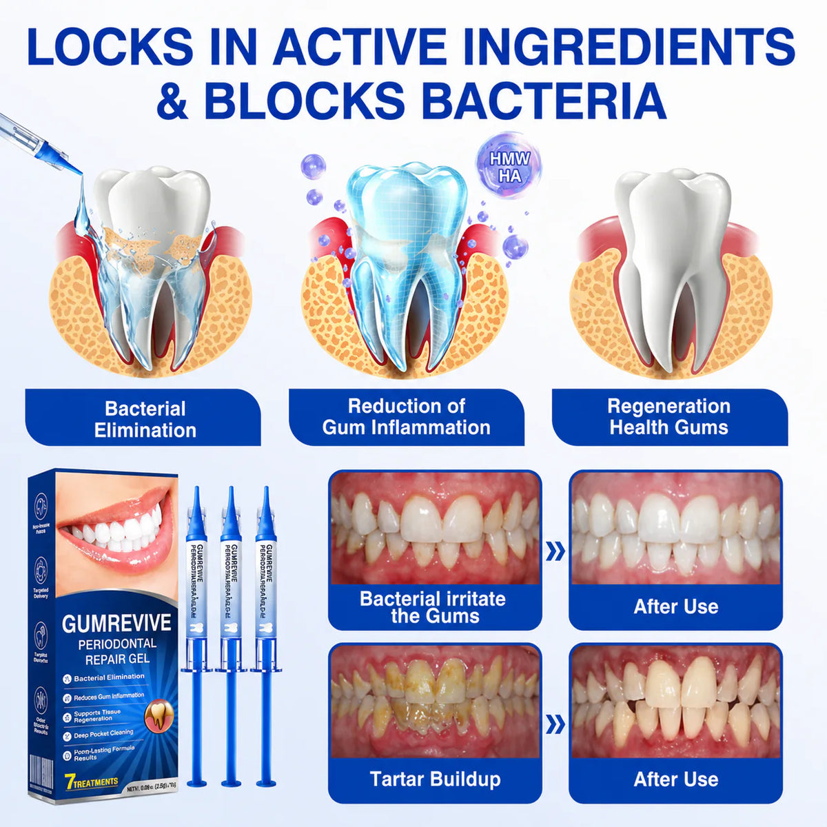 Periodontal Repair Gel