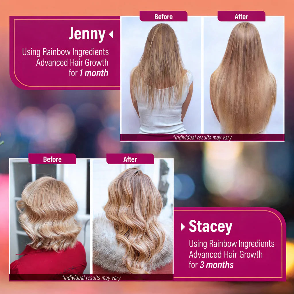 24-in-1 ADVANCED HAIR GROWTH SUPPLEMENT