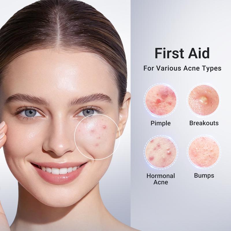 Dr. Leo's Salicylic Acid Drying Lotion for Acne Treatment